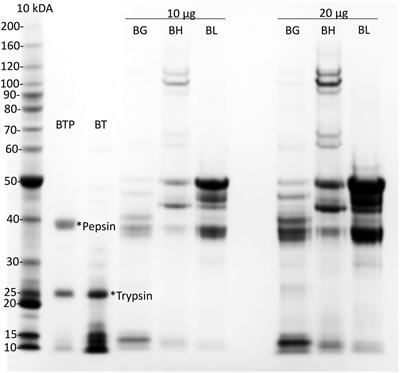 Relative Rates of Gluten Digestion by Nine Commercial Dietary Digestive Supplements